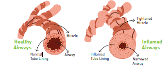 airways